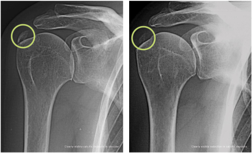 calcification – Poliklinika Reha